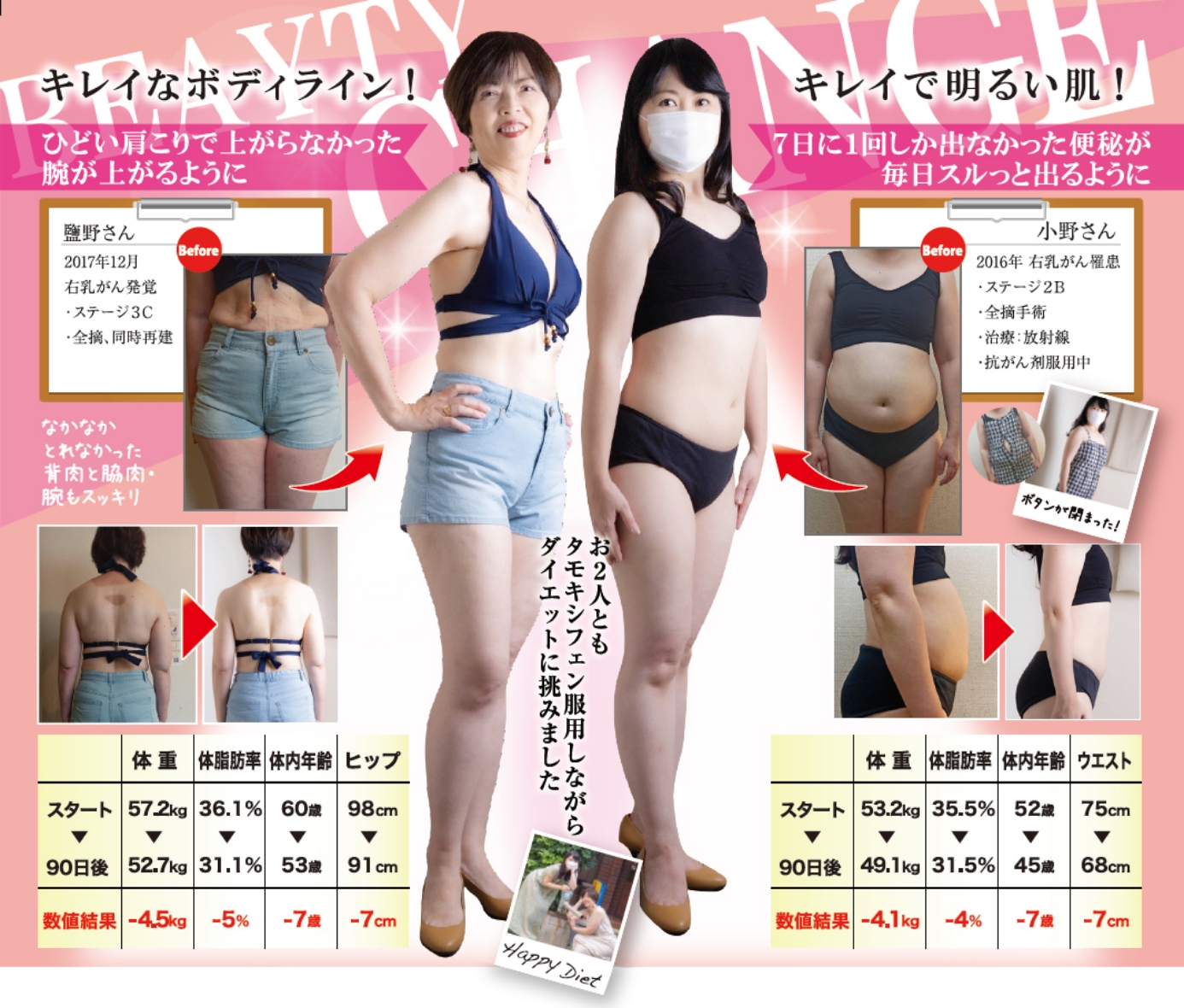 癌サバイバーのダイエットエステ